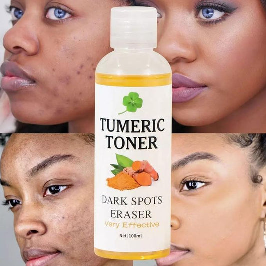 Dark Spots Corrector Acne Remover  Tumeric Toner