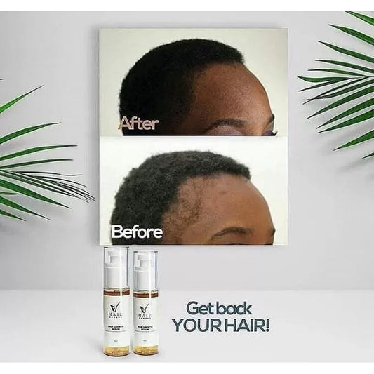 Hair Now Now Hair Growth Serum