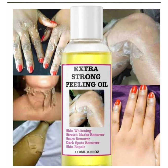 Extra Strong Yellow Peeling Oil For Skin Perfection