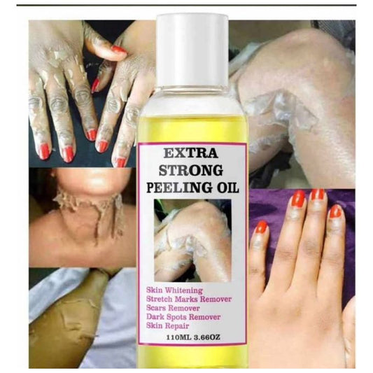 Extra Strong Yellow Peeling Oil For Skin Perfection