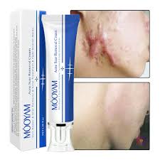 MOOYAM Strong Effective Acne Scar Removal Cream Pimples Stretch Marks Face Gel Tummy Tuck Tightening Stretch Mark Removal Cream