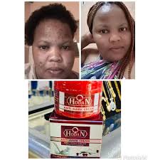 Hodan Anti-Mark Dark Spots Clearing Skin Moisturizing Brighteniing Cream.